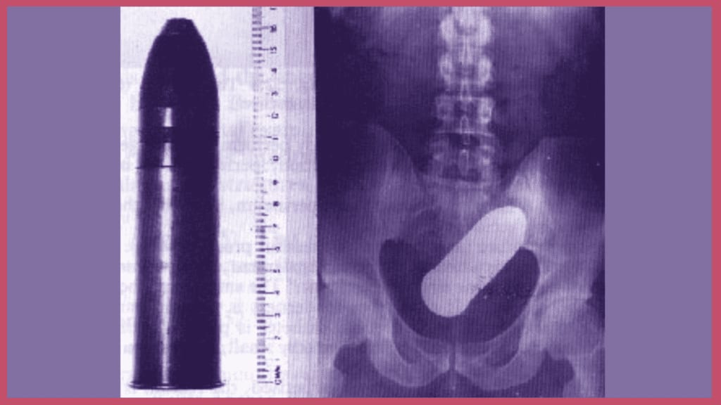 Var : il se présente aux urgences avec un obus dans l’anus