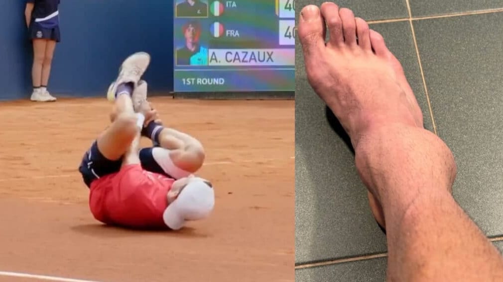 Le tennisman Montpelliérain Arthur Cazaux se blesse à la cheville lors du tournoi de Barcelone