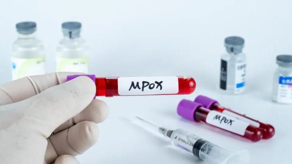 Variole du singe – Mpox: le système de santé français placé en « état de vigilance maximale »
