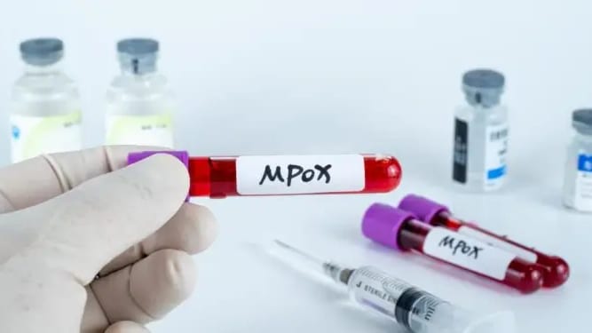 Occitanie : où faire un vaccin préventif contre le virus Mpox ?
