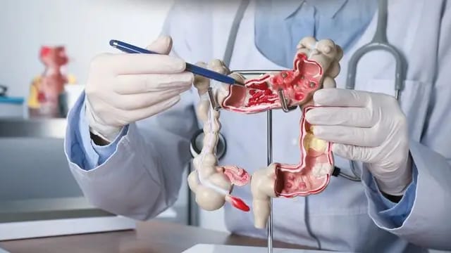 Le COLON TOUR fait escale à Sète dans l'Hérault - photo d'illustration INFOCCITANIE