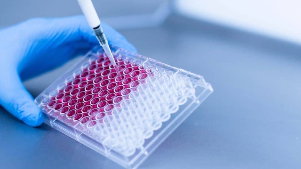 CHU de Montpellier  : une thérapie génique prometteuse contre la mucoviscidose