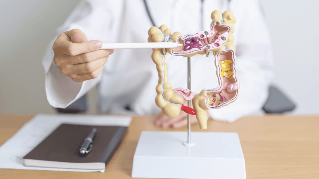 Carcassonne : une journée de sensibilisation au dépistage du cancer colorectal